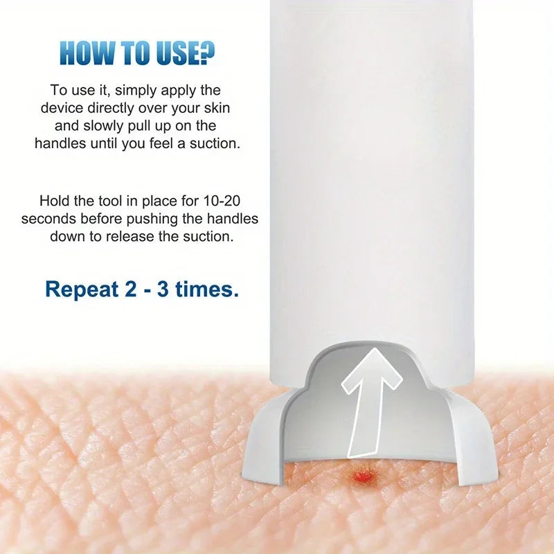 Bug Bite Venom Extractor